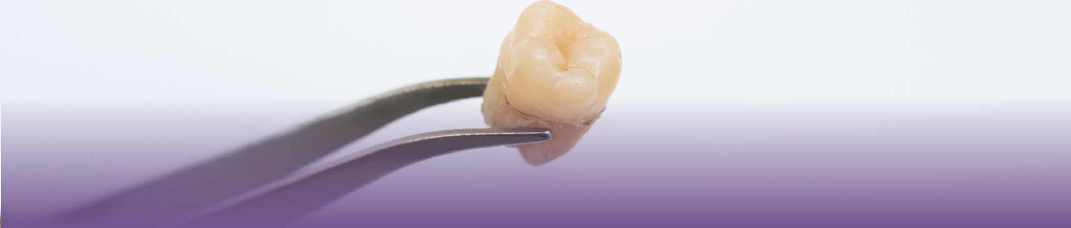 Tweezers holding an extracted tooth